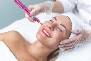 Micro Needling-Tactus-Health