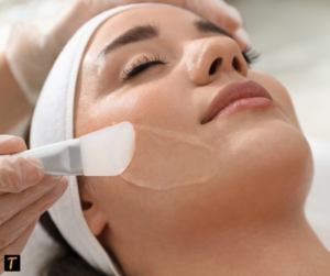 Chemical Peels in Buford