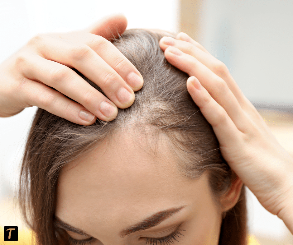 Causes of Hair Loss