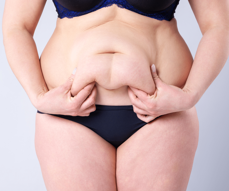 Non-Surgical Alternatives to a Tummy Tuck