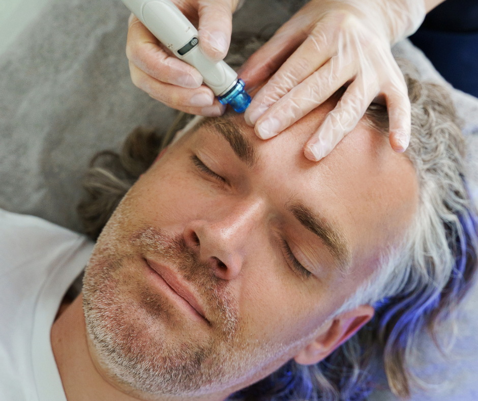 Hydrafacial in Sugar Hill