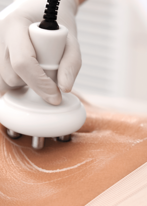 Lipo Cavitation treatment in Sugar Hil